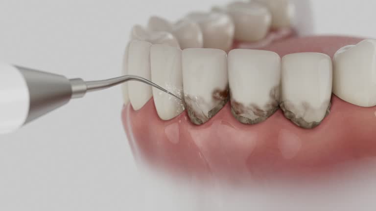 Reliable Dental contractor in Bernie, MO by Smile Center Dentistry